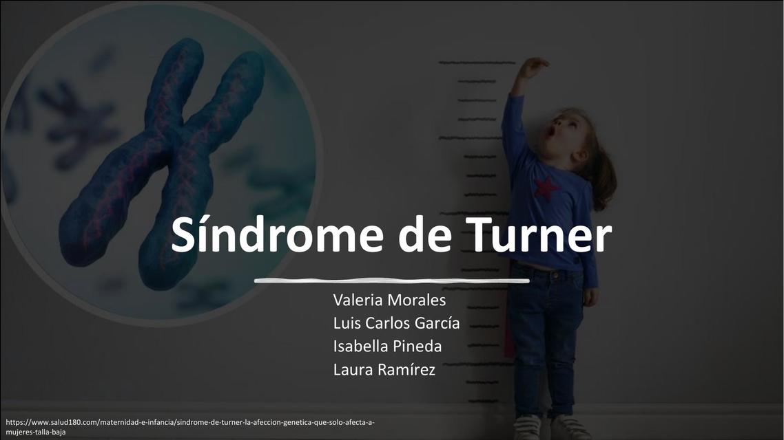 Síndrome de Turner