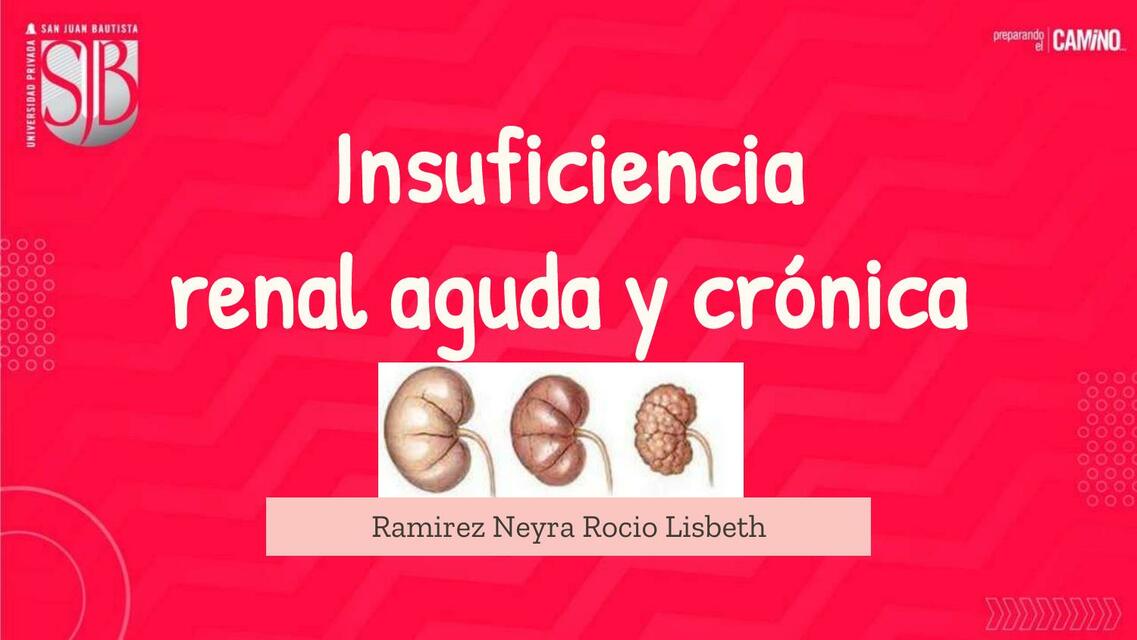 Insuficiencia Renal Aguda y Crónica 