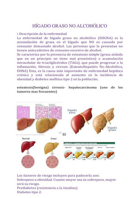 Hígado Graso No Alcohólico 