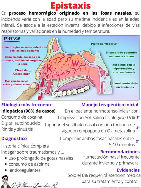 Epistaxis Jos Williams Zuccolotto Ram n UDocz epistaxis-jos-williams-zuccolotto-ram-n-udocz