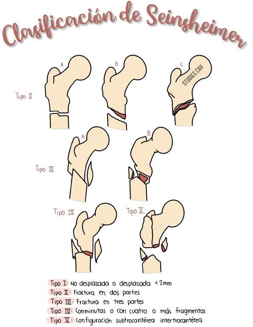 Clasificación de Seinsheimer