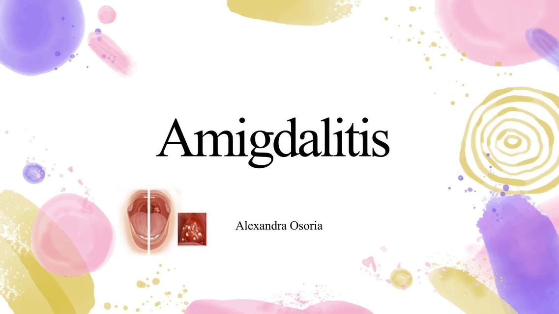 Amigdalitis 