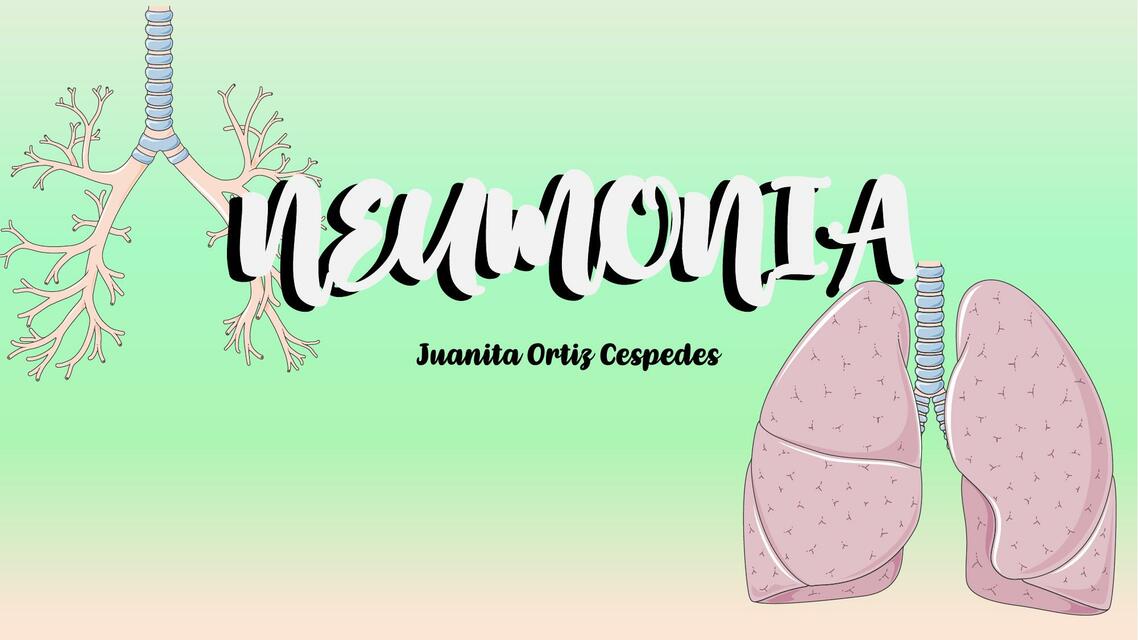 Neunomia