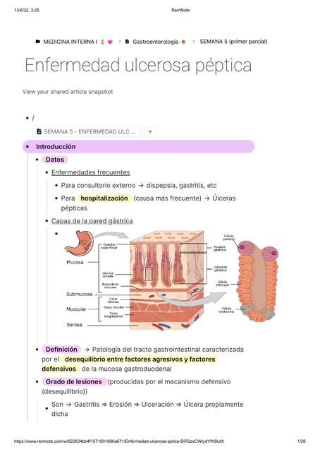 Úlcera Péptica