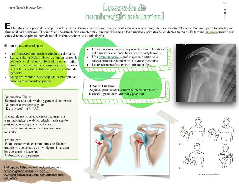 maniobra de kocher hombro