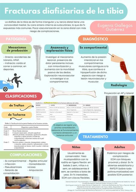 Fracturas diafisiarias de la tibia