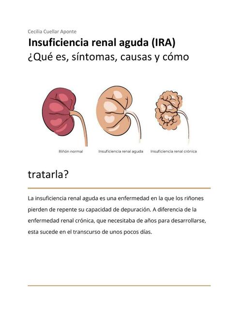 Insuficiencia Renal Aguda (IRA)