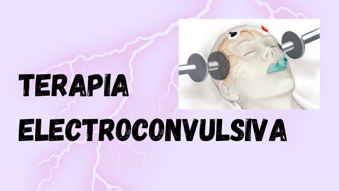 Terapia Electroconvulsiva