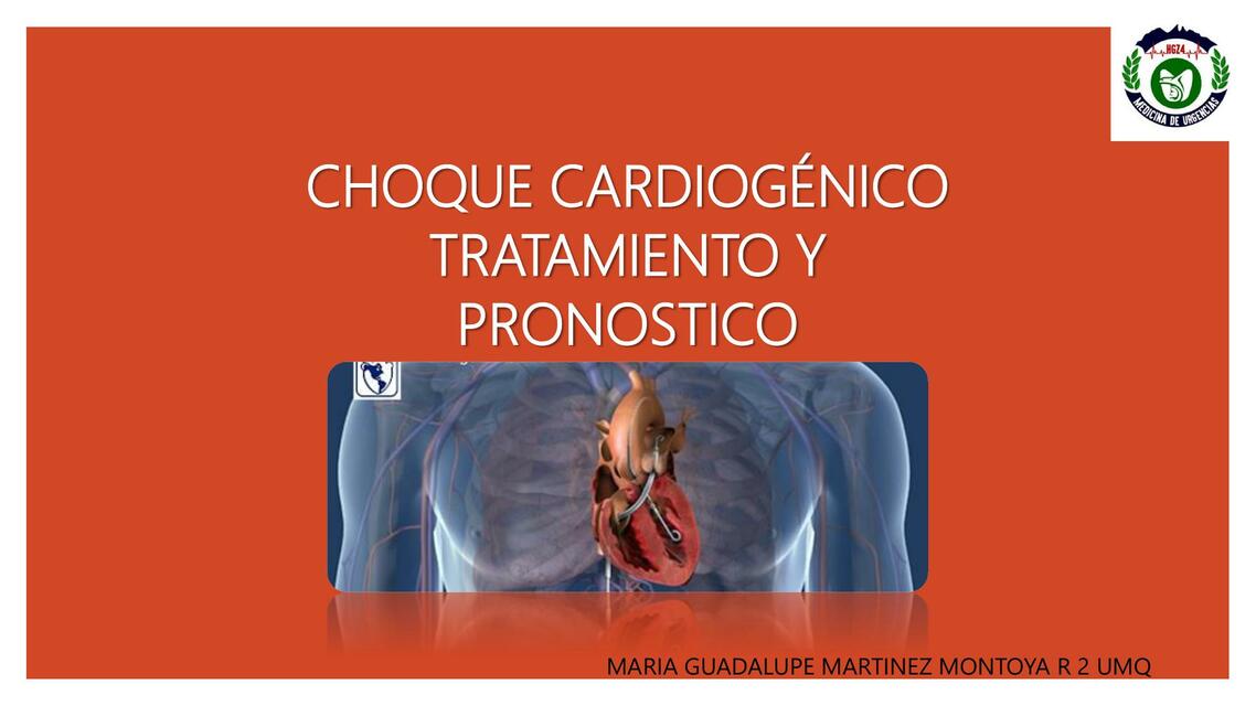 Choque Cardiogénico 