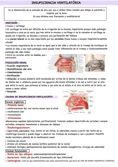 Insuficiencia Ventilatoria Nasal 