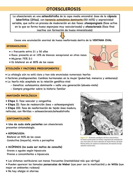 Otoesclerosis 