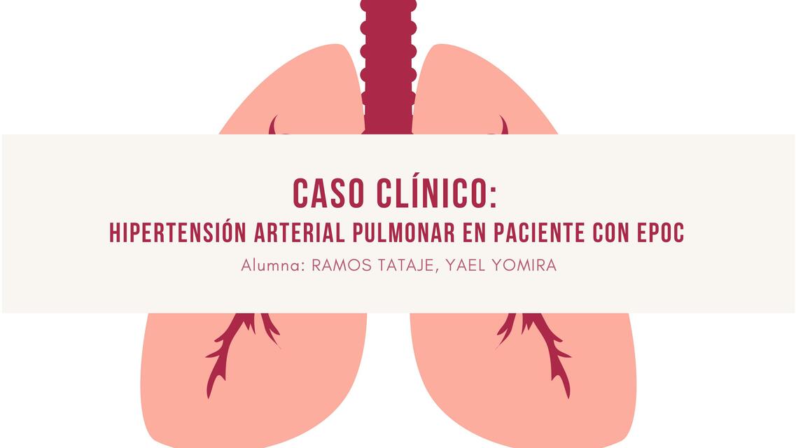 Hipertensión Arterial Pulmonar 