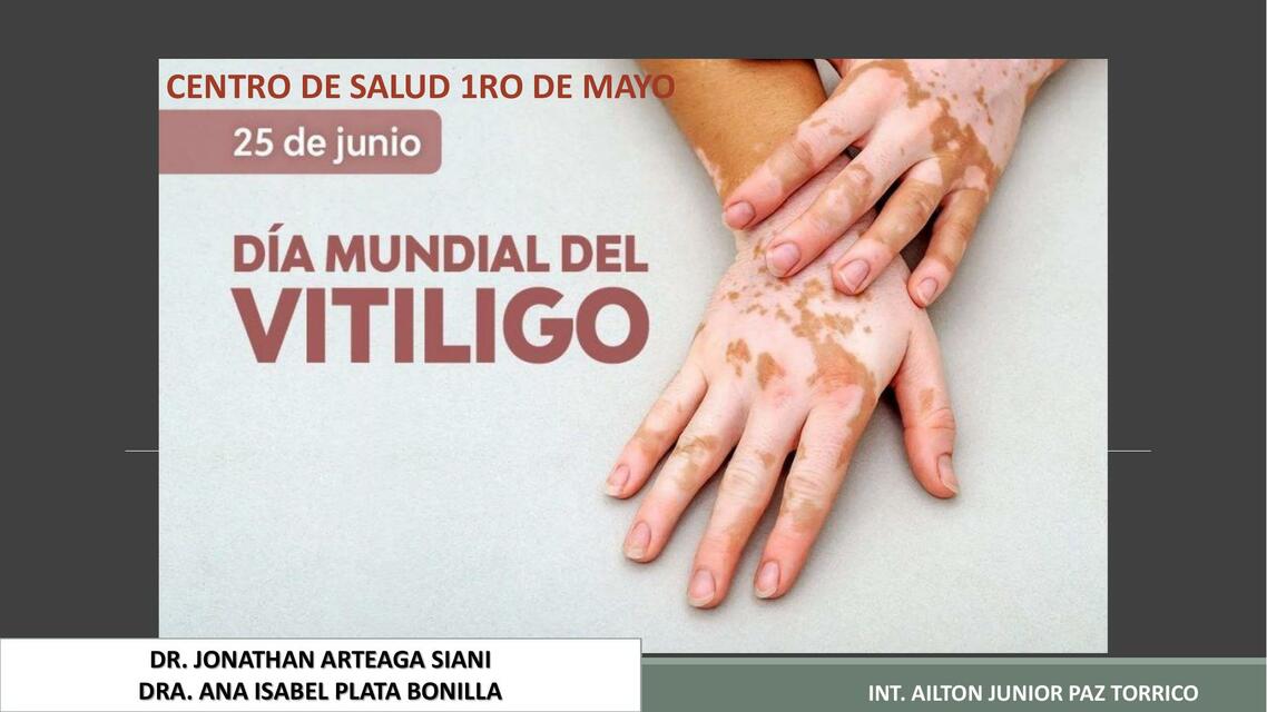 Vitiligo