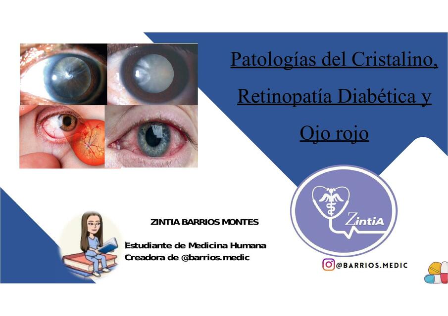Patologías del Cristalino Retinopatía Diabética y Ojo rojo Patologías del Cristalino Retinopatía Diabética y Ojo rojo