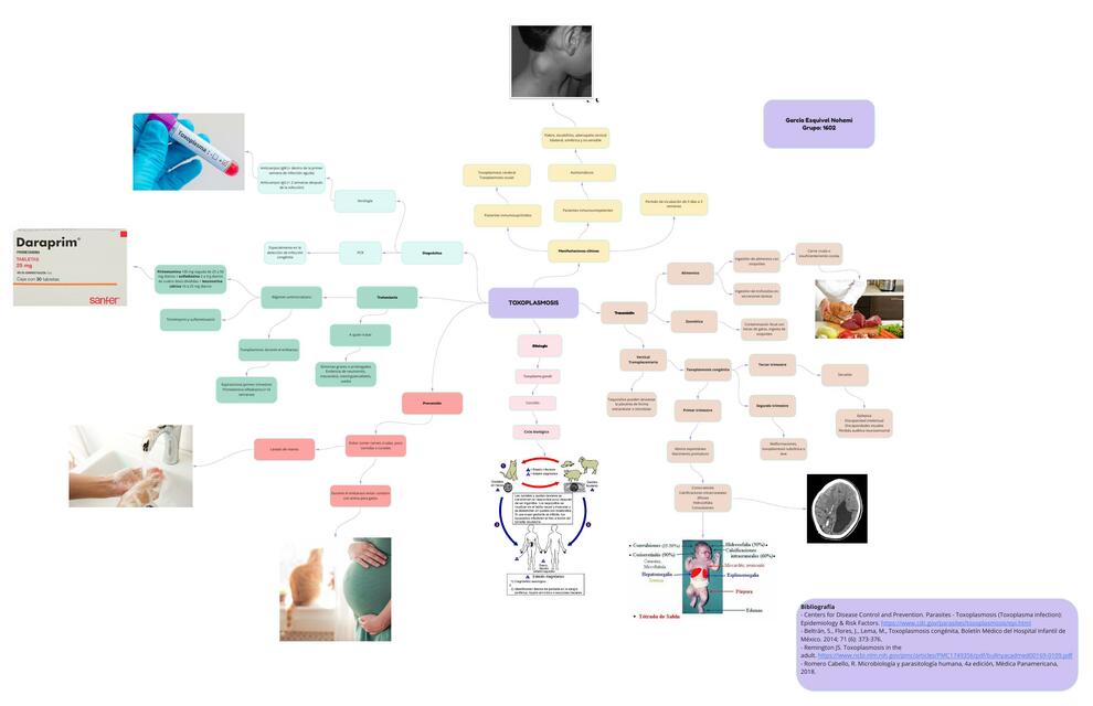 Toxoplasmosis