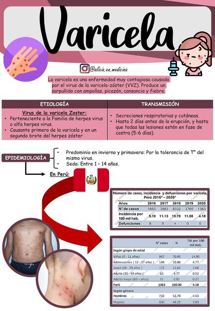 Varicela Pediatría