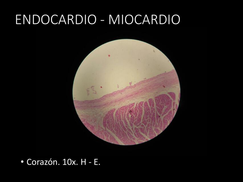 Endocardio- Miocardio 