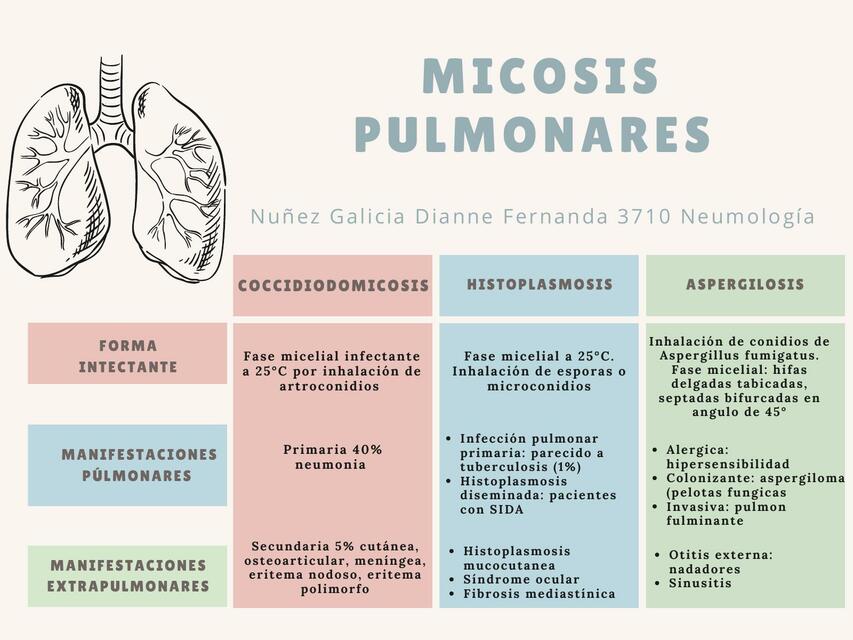 Micosis Pulmonares