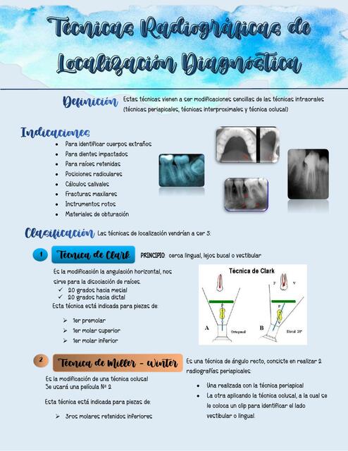 Técnicas Radiográficas de Localización Diagnóstica 