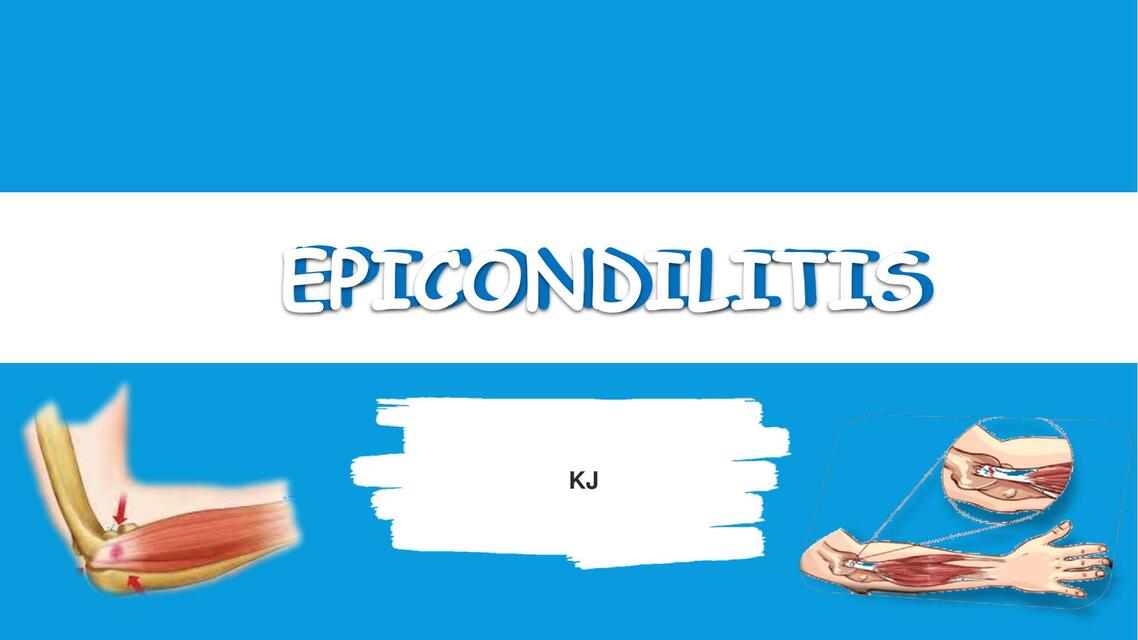 Epicondilitis | Key Monzón | uDocz