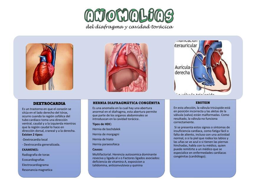 Anomalías del Diafragma y Cavidad Torácica 