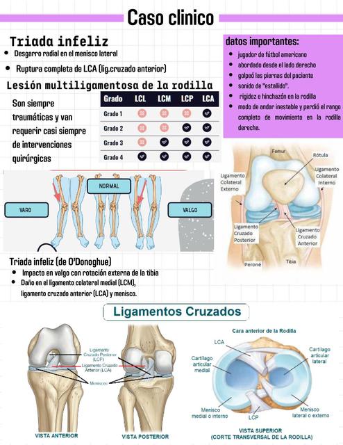 Tríada Infeliz de O Donoghue