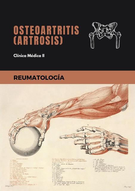 Osteoartritis Artrosis