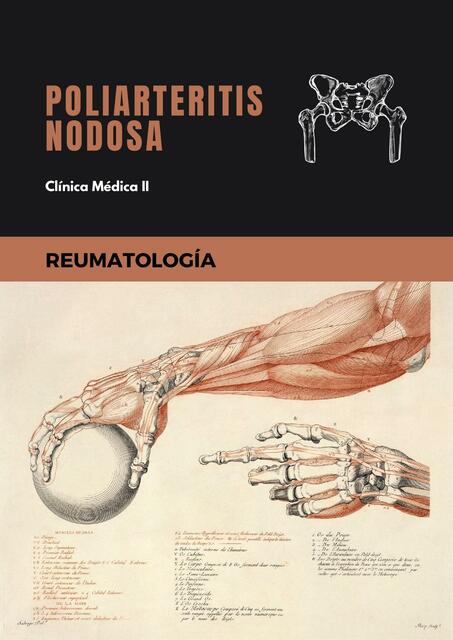 Poliarteritis Nodosa