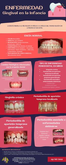 Gingivitis en la Infancia 