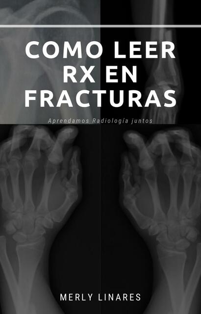 Como leer una Rx en fracturas | Sabiduría Médica | uDocz