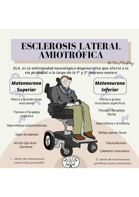 Esclerosis lateral amiotrófica