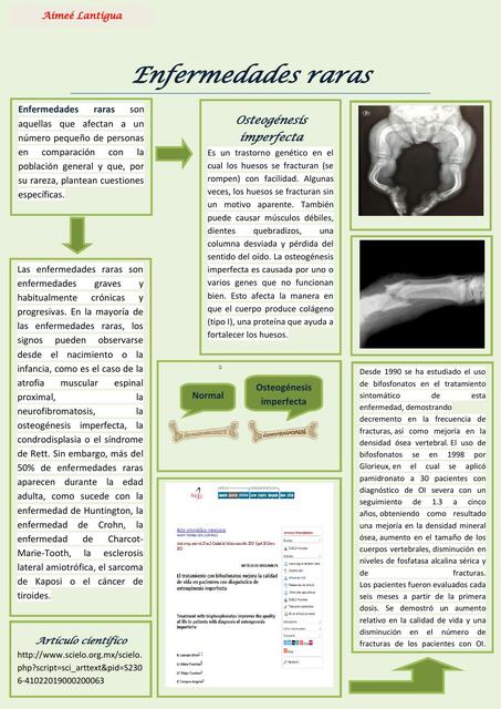 Enfermedades raras 