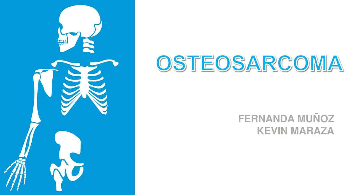 Osteosarcoma 