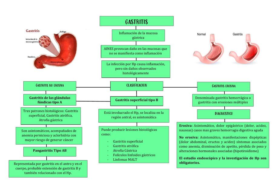 Gastritis 