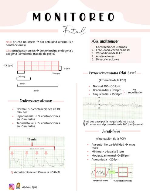 Monitoreo Fetal 