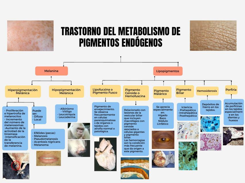 Trastornos del Metabolismo de Pigmentos Endógenos 