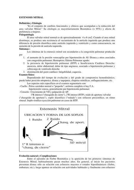 Estenosis Mitral