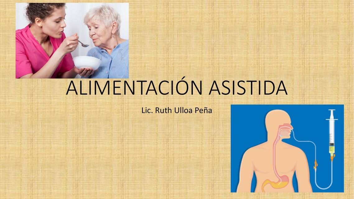 Alimentación Asistida 