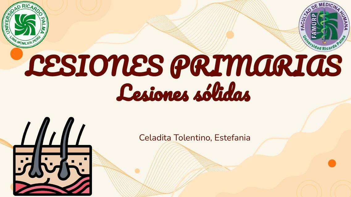 Lesiones Primarias- Lesiones Sólidas