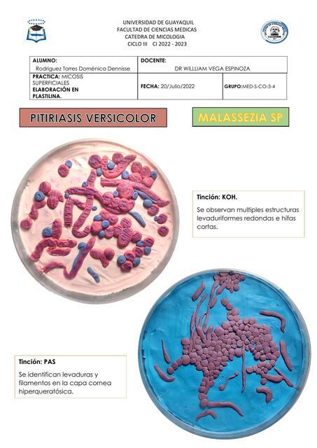 Práctica Micosis