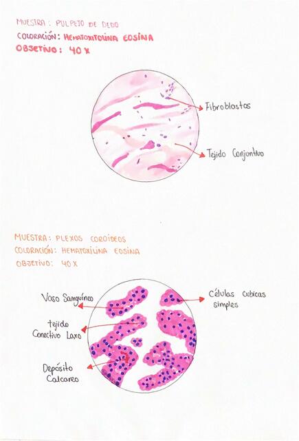 Histología Pulplejo de Dedo y Plexos Coroideos