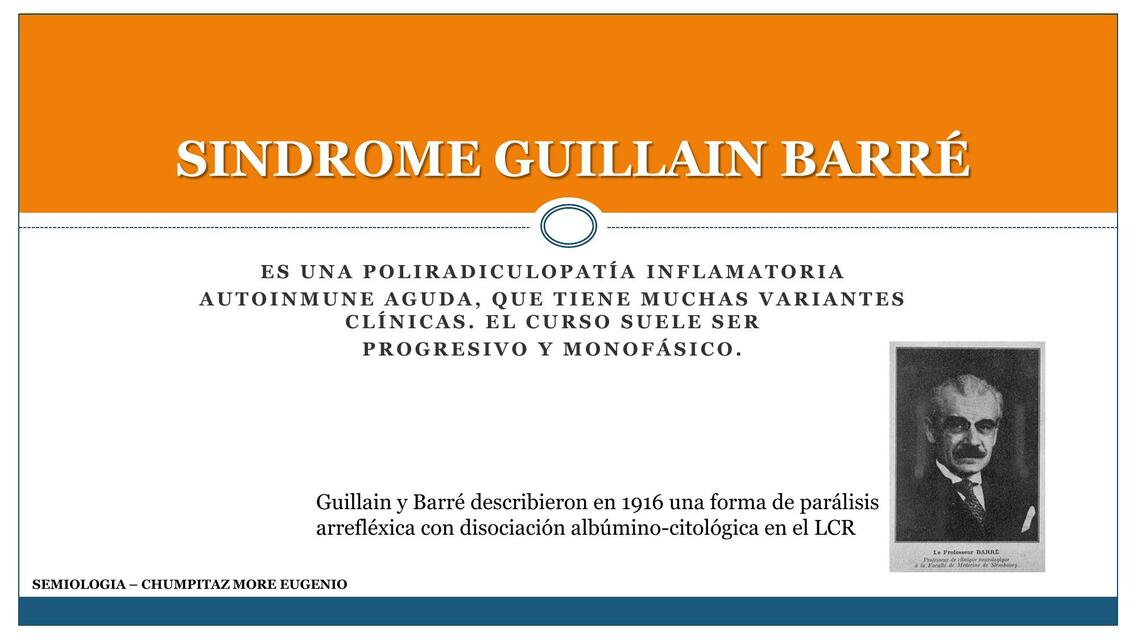 Sindrome de Guillain Barré