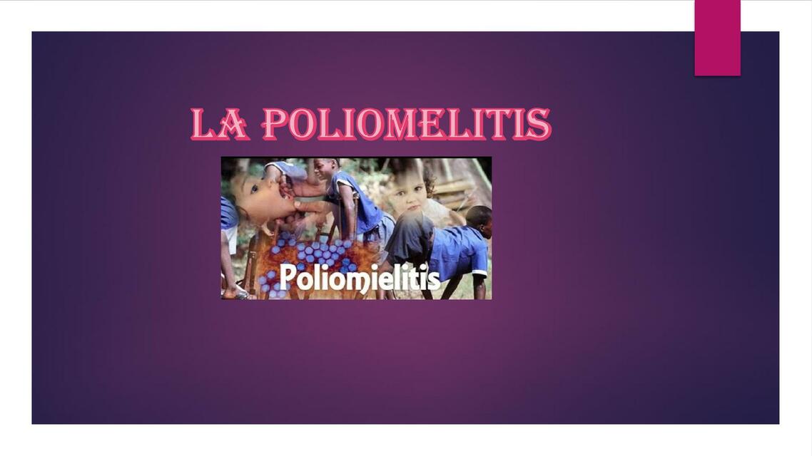 La Poliomelitis