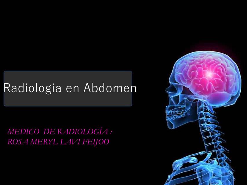 Radiología en Abdomen