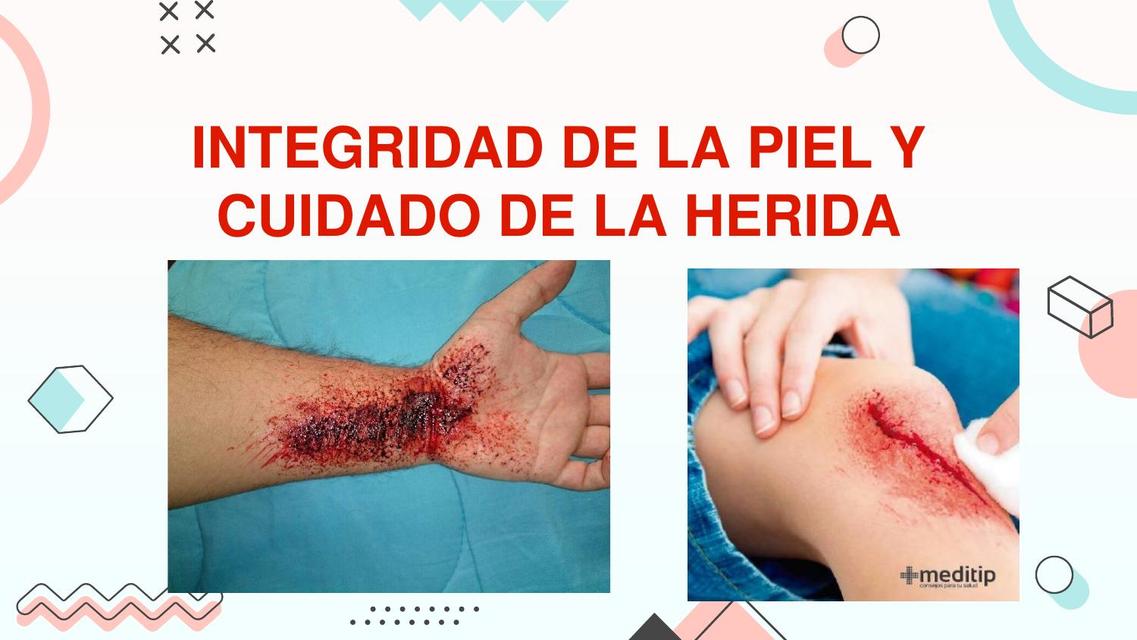 Integridad de la Piel y Cuidado de la Herida