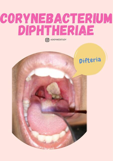 Corynebacterium Diphtheriae