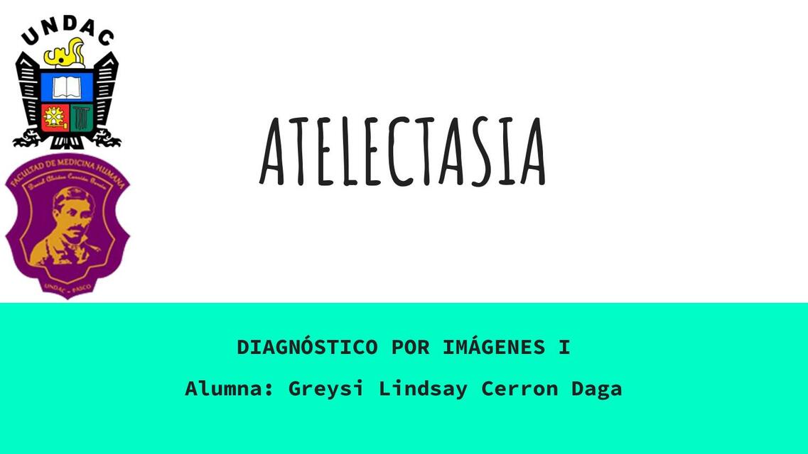 Atelactasia - Patrón radiológico 