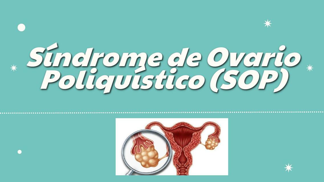 Síndrome de Ovario Poliquístico