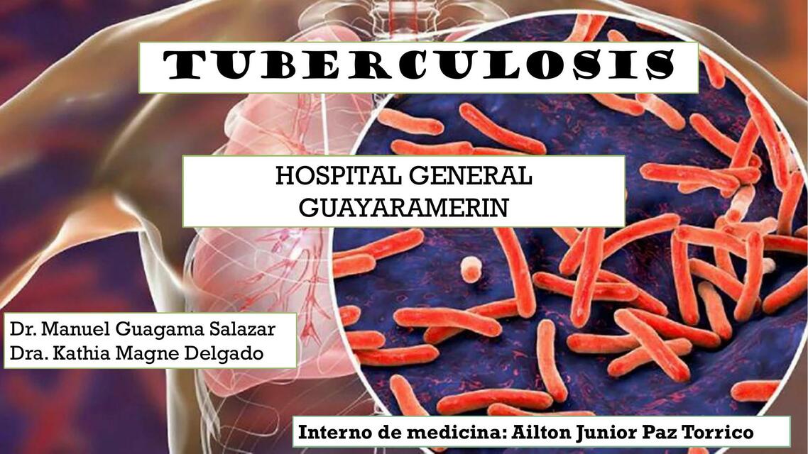 Tuberculosis