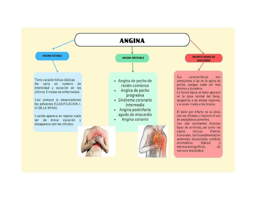 Angina